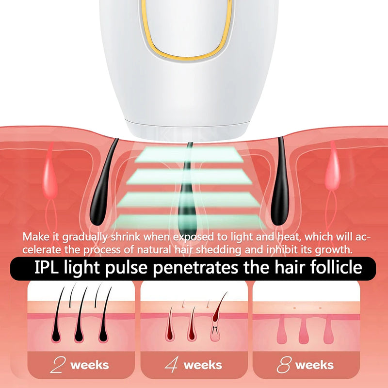 Depilador a Laser IPL Permanente - Remoção de Pelos Sem Dor para Mulheres